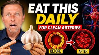 Eat This Daily to Clean Out Your Arteries
