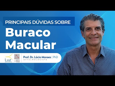 Dúvidas Sobre Buraco Macular