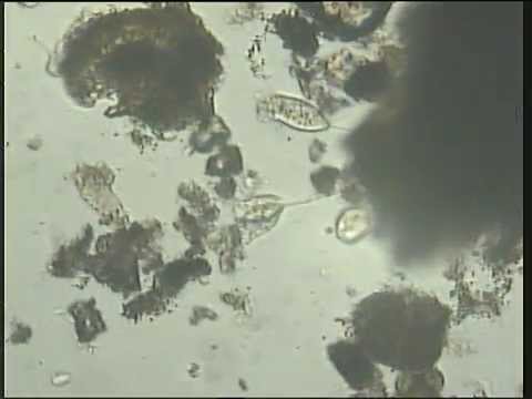 Vorticellas microstomas x 10 Adry