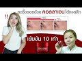 ร้อยไหม คอ ล ลา เจน