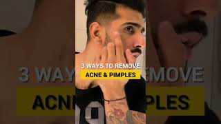 Get Rid of PIMPLES Fast | Abhinav Mahajan #shorts