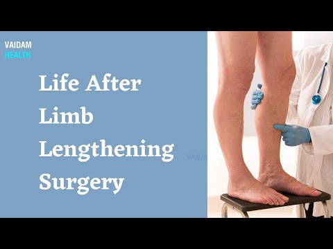 Life After Limb Lengthening Surgery
