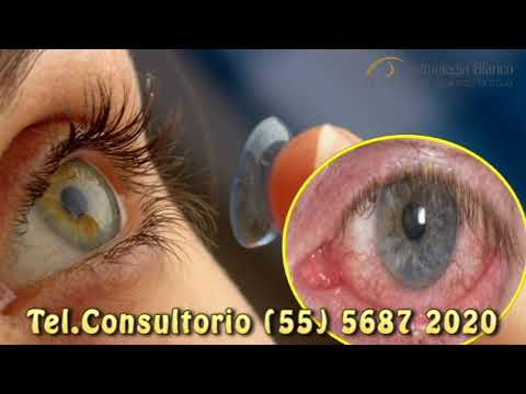 Irritación de los Ojos