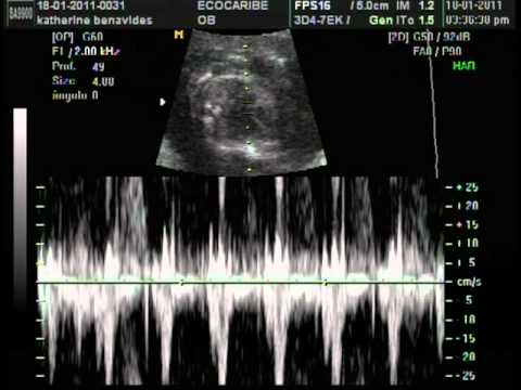 MI HERMOSA PRINCESA VALERIE