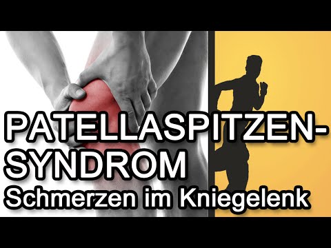 Schmerzen im Kniegelenk Behandlung Gelenkentzündung nach der Verletzung