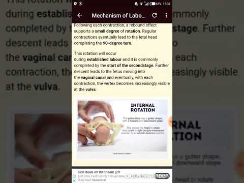 Obst & Gynecology, Pediatrics & Urology Mnemonics Video