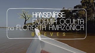Hanseníase: Endemia Oculta na Floresta Amazônica