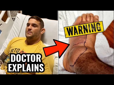 Dustin Poirier Shares Images of BAD Foot Infection - Doctor Explains