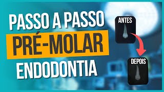 Endodontia pré-molar completa (tratamento de canal)