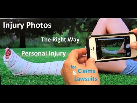 download lagu mp3 mp4 How Long Does A Personal Injury Claim Take, download lagu How Long Does A Personal Injury Claim Take gratis, unduh video klip How Long Does A Personal Injury Claim Take