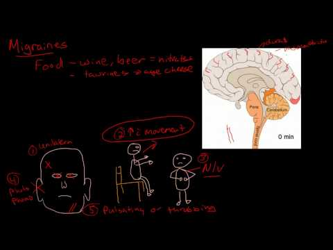 Migraine Pathophysiology