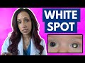 White Spot In Your Baby's Eye? Eye Doctor Explains