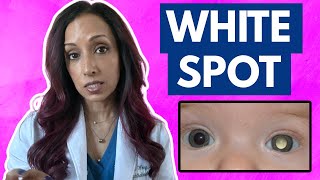 White Spot In Your Baby