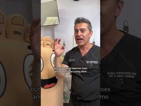 Doctor Reacts: Reconditioning Feet with Rock Grips