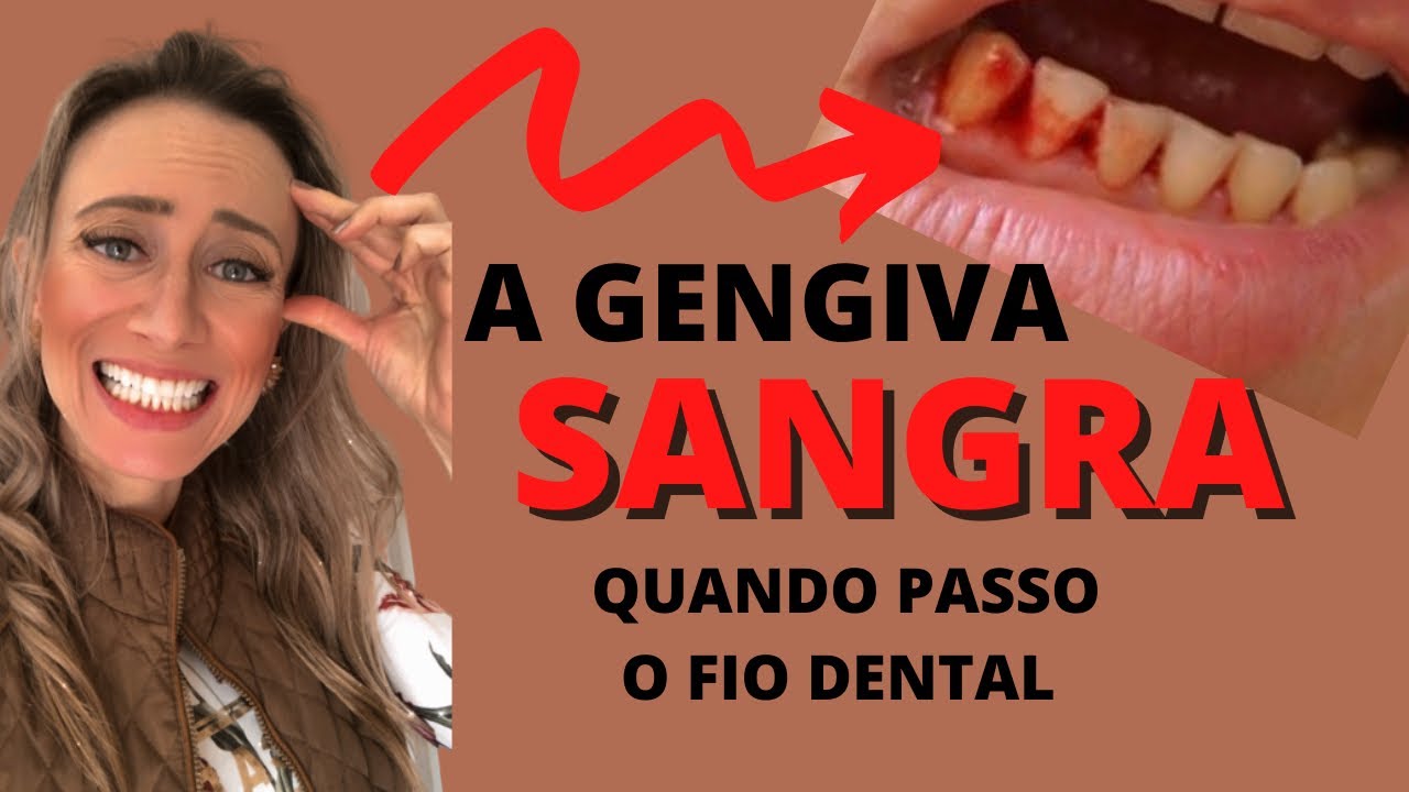 Quando passo fio dental, minha gengiva sangra!😰 DEVO PASSAR mesmo assim