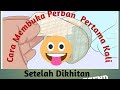Membuka Perban Pertama Kali Sehabis Khitan Khitanan Sunat