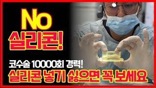 코에 실리콘 넣기싫으면 꼭 보세요! 3D 자가늑입자 보형물 리브핏