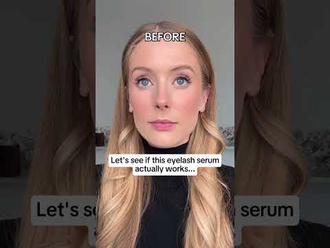 Ergebnisse des Wimpernserums… OMG 😳