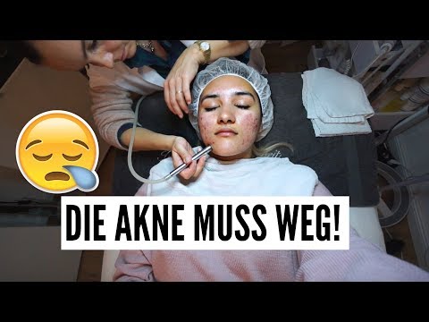 Die neuen Technologien auf den Behandlungen der Schuppenflechte Ob man bei atopitscheski die Hautentzündung gebären kann