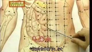 Acupuncture DVD, Chinese Medicine, English Subtitled