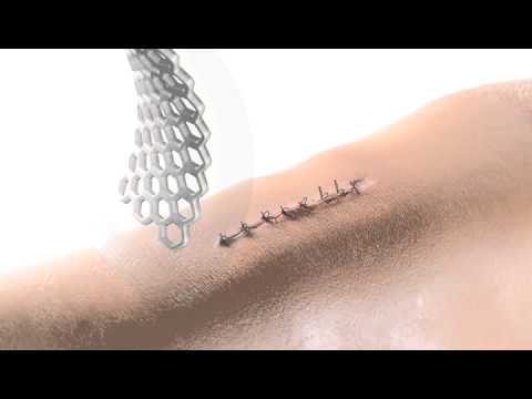 Smith Nephew Opsite Surgical  Dressing