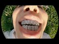 Lil Kera Swan Pressure Ft Bagaicha Boys Official Music Video