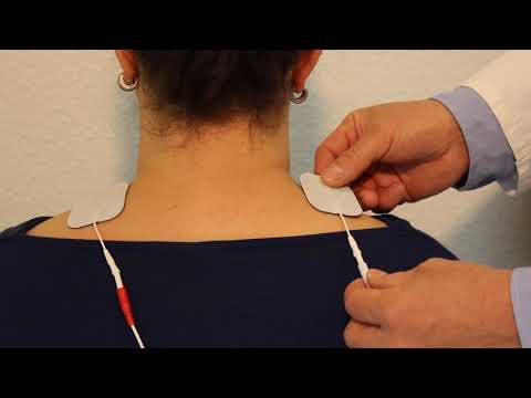 Elektrodenanlage bei Spannungskopfschmerzen mit TENStem eco basic DE