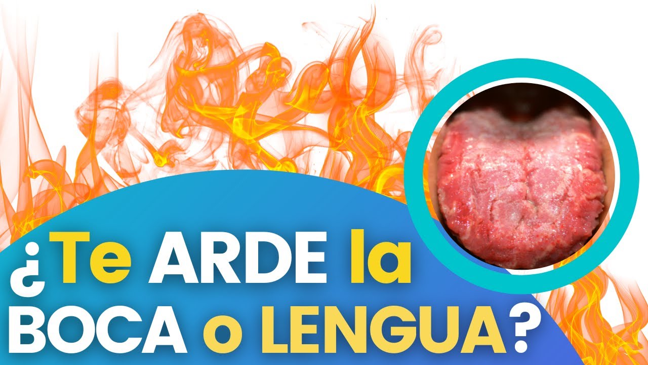 🔥¿Te ARDE la BOCA o la LENGUA Síndrome de Boca Ardiente: TODO LO QUE DEBES SABER😱🔥