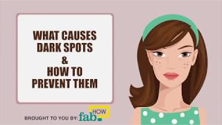 What Causes Dark Spots & Blemishes on Face and How to Prevent