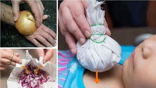 12 Unexpected Ways To Use Onion You Didn't Know About Earth