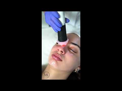 GENEO – 3-en-1 Super Facial