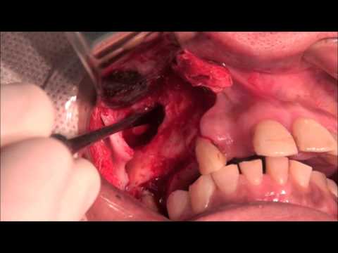 download lagu mp3 mp4 Capato, download lagu Capato gratis, unduh video klip Download Capato Mp3 dan Mp4 Music Gratis