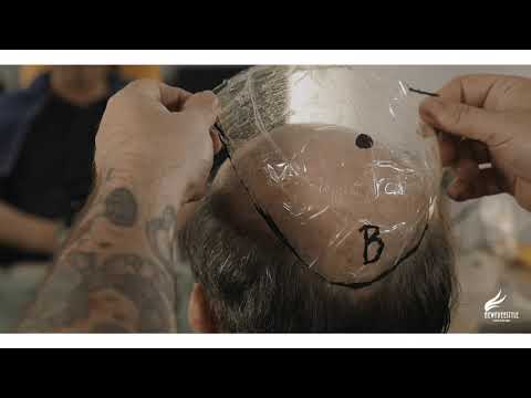 Newfreestyle Hair System video thumbnail