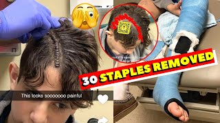 NIDAL IS GETTING 30 STAPLES REMOVED FROM HIS HEAD🫣 (Doctor checkup)
