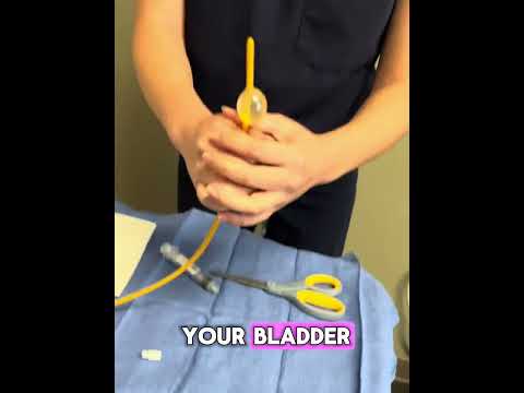 How to Remove a Bladder Catheter