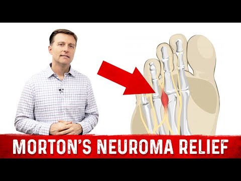 Sciatic Nerve Pain Be Gone Dr Berg s Quick Fix Solutions