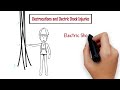 Electrocutions And Electric Shock Injuries