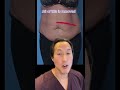 Watch This Tummy Transformation Shorts Tummytuck