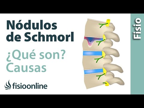Sottopiedi articolazioni del ginocchio Reclami di dolore alle articolazioni