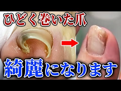 施術動画1