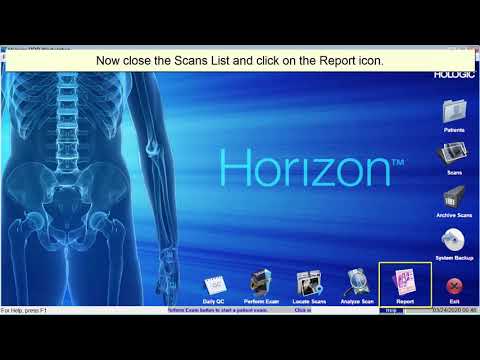 Transferring Scans From Hologic