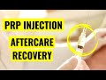 PRP Aftercare Instructions And Recovery Protocol