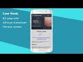 Android Smart Search Video