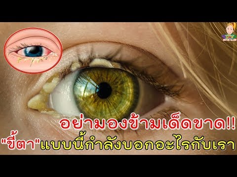 แชมพู emolium สำหรับโรคสะเก็ดเงิน Kartalin คิดเห็นกลากครีม