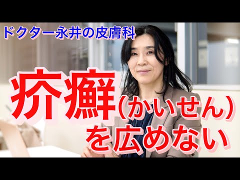 耐性のある植物 vs 干ばつ: 疥癬を選択する理由と庭でそれをうまく維持する方法  庭園