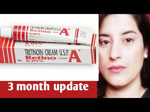 Tretinoin Cream Review/3 Months Update/Retin A Cream