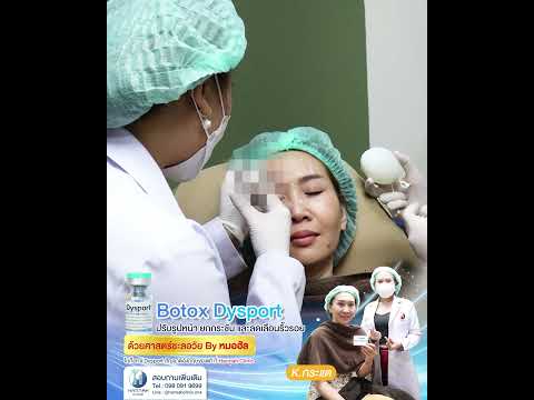 รีวิวหัตถการโปรแกรมโบท็อก Dysport
