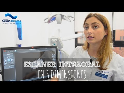 Escaner intraoral en 3 dimensiones