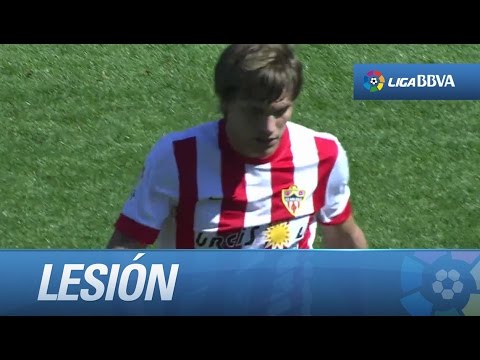 Lesión de Dubarbier