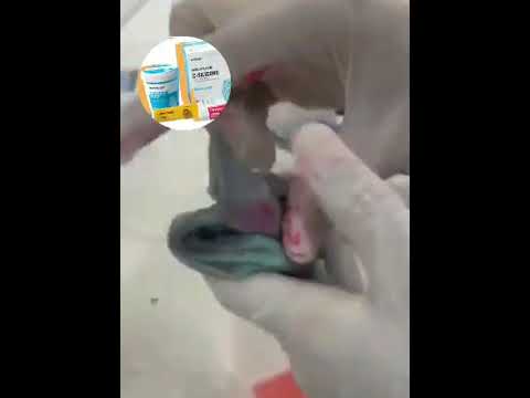 HOW to use zeta plus C-silicone impression putty #impression #orthodontictreatment #dentalartistry